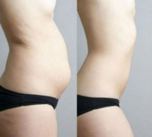 media_146366154865916200